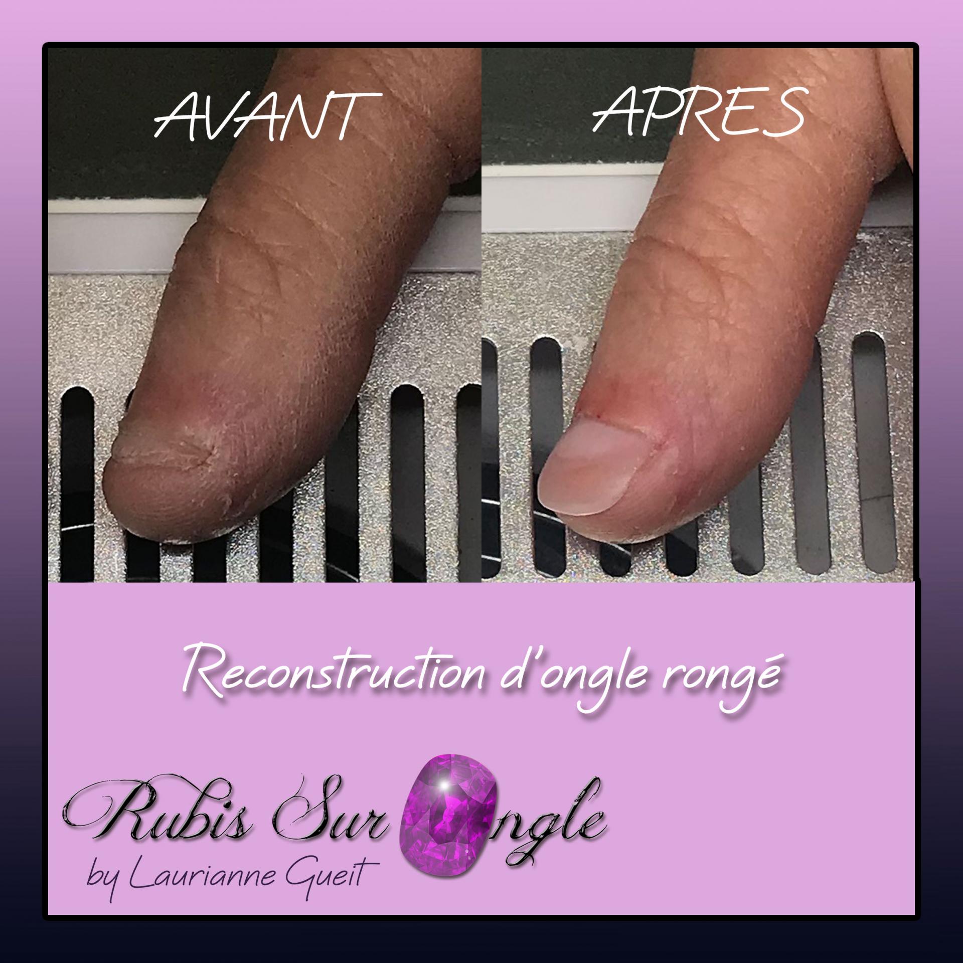 Rubis Sur Ongle Manucure avant après