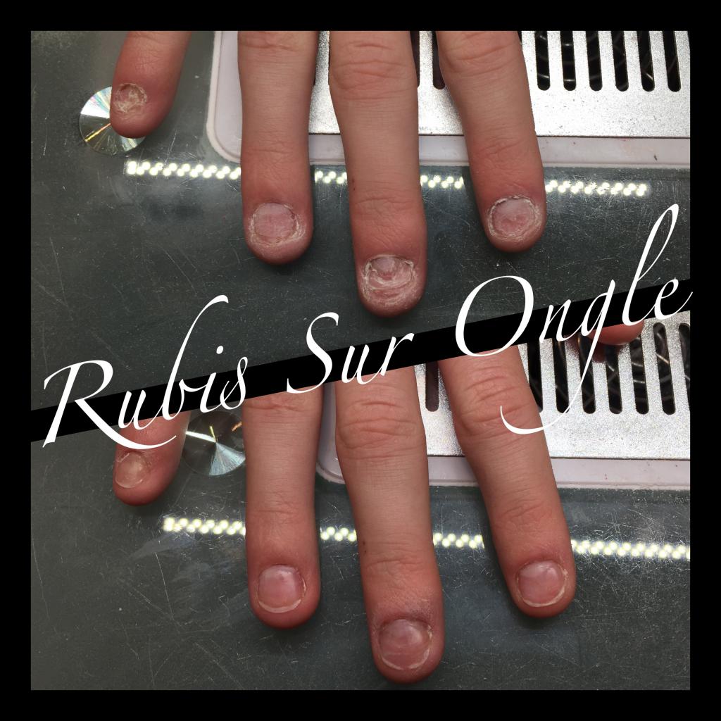 Rubis Sur Ongle