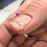 Chablon Rubis Sur Ongle Lauris
