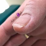 Chablon Rubis Sur Ongle Lauris
